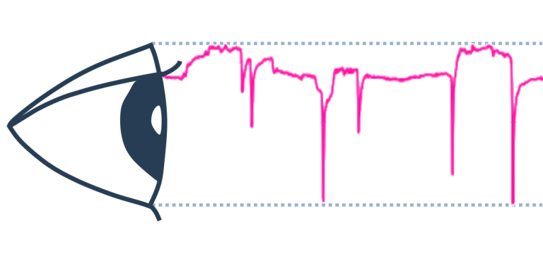 eyelid diagram that shows The JDS algorithm derives 64 mathematical parameters from the eyelid signal and tracks them over time.